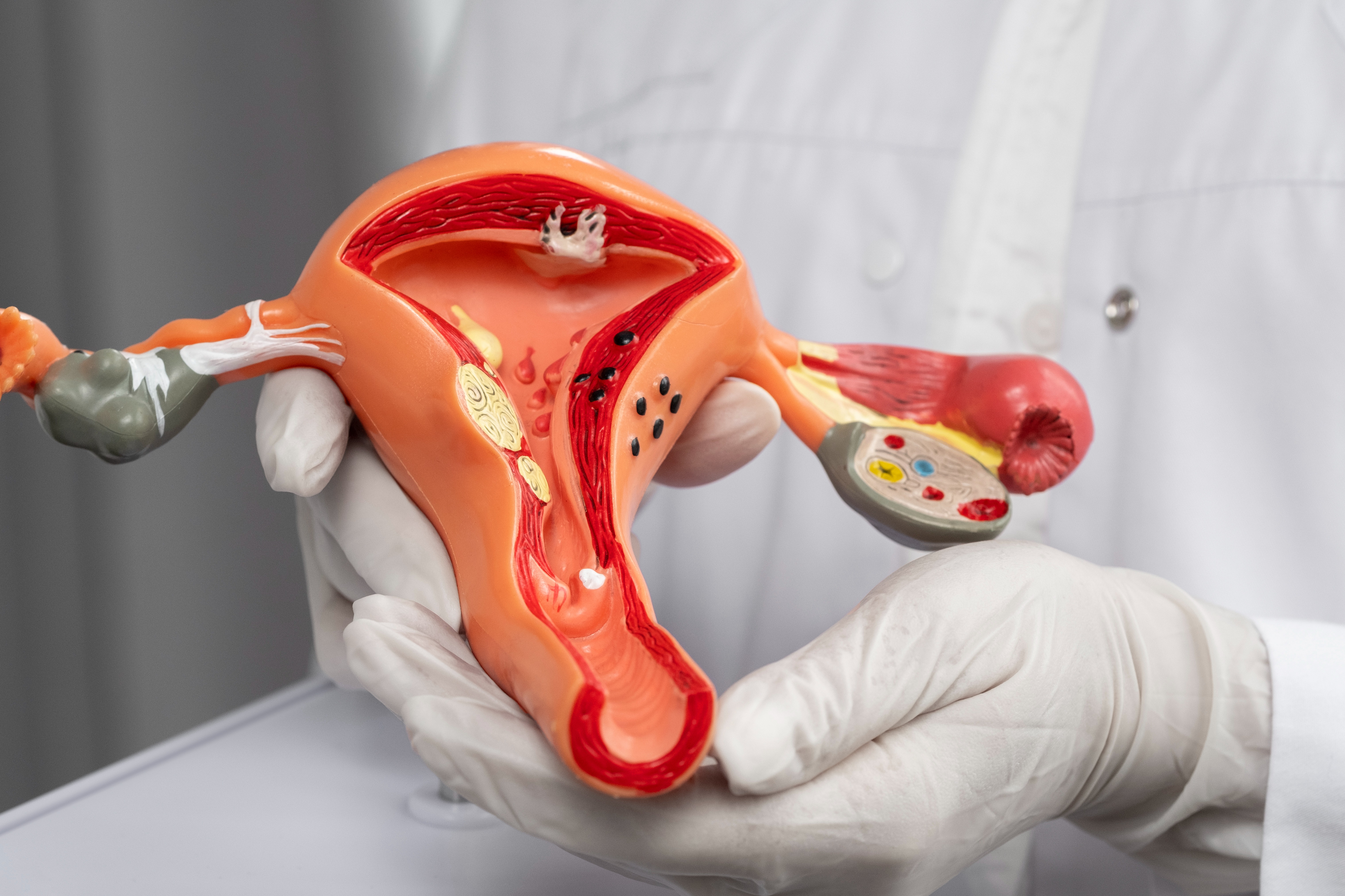  possvel engravidar com trompas uterinas obstrudas?