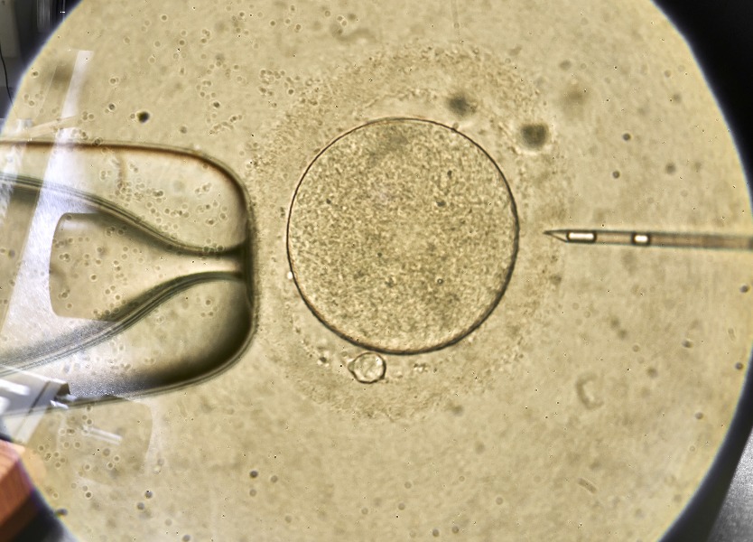O que  Fertilizao In Vitro com ICSI